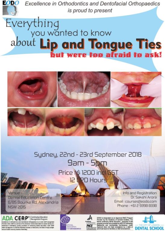 Tongue Tie Course EODO Tongue Tie Course EODO
